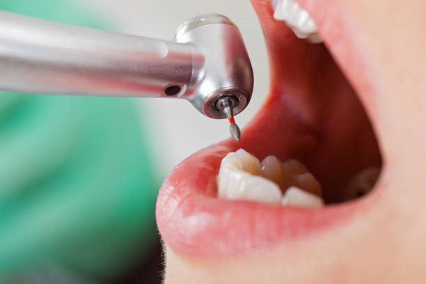 Best Root Canal Emergency Dentist  in Windsor, VA